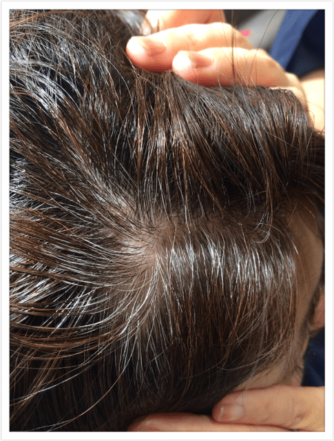バンコクATAMAヘアーサロンの白髪イメージ